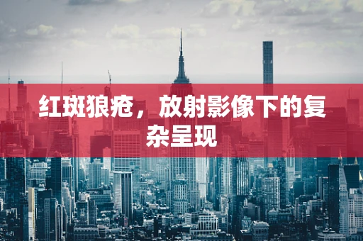 红斑狼疮，放射影像下的复杂呈现