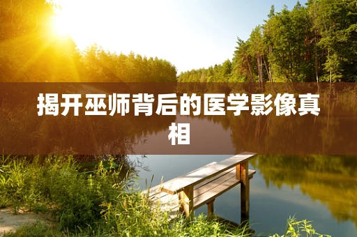 揭开巫师背后的医学影像真相