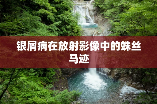银屑病在放射影像中的蛛丝马迹